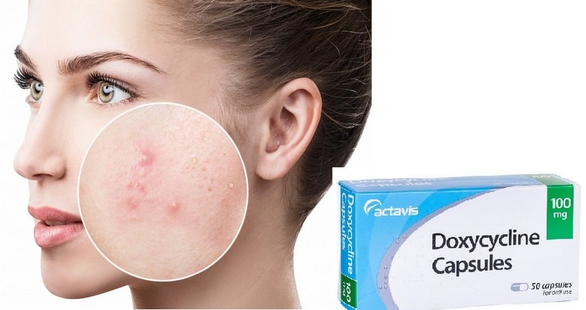 Doxiciclina-l'acne
